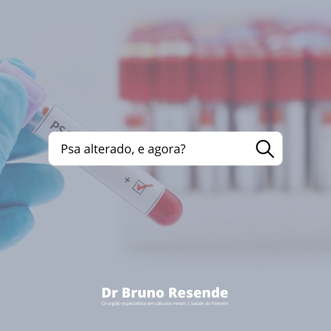 PSA alterado, e agora? Dr. Bruno Resende Urologista PSA alterado, e agora? Dr. Bruno Resende Urologista